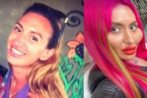 Người ta bơm vòng nọ vòng kia, riêng cô này chỉ bơm má để có 'hai gò má to nhất thế giới'