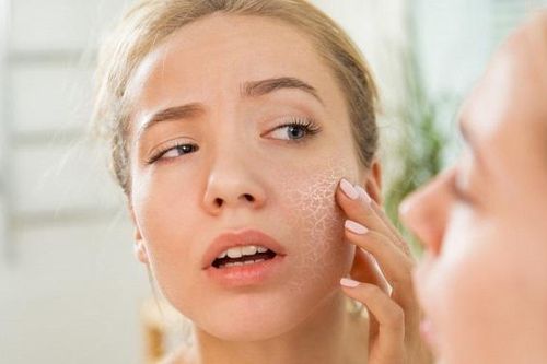 Các bước chăm sóc da khô cấp ẩm đầy đủ mà phái đẹp không thể bỏ qua trong mùa thu