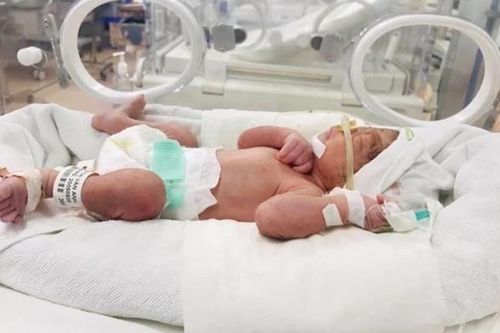 Lần đầu tiên thí điểm mạng lưới sơ sinh Hà Nội