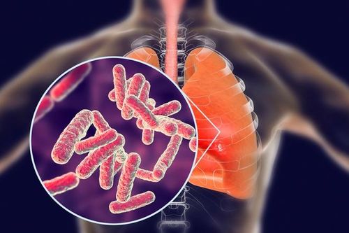 Nam sinh tử vong vì lao ruột hiếm gặp