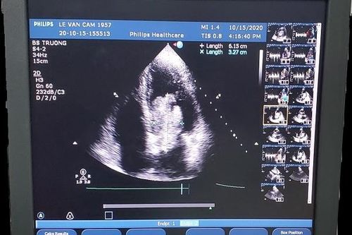 Xuyên đêm cứu sống bệnh nhân u tim