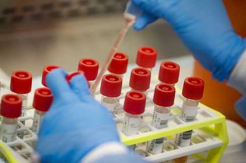 New York có kế hoạch tiêm vaccine ngừa Covid-19, Mỹ phê duyệt bộ xét nghiệm tại nhà