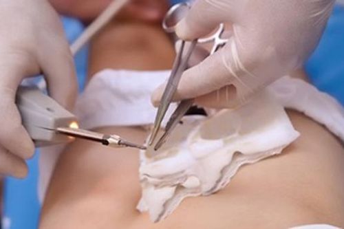 Chàng trai miền Tây đau đớn nhập viện vì gãy dương vật