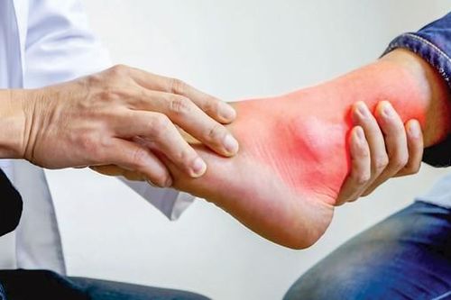Không chủ quan điều trị bệnh gout