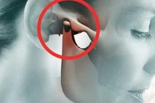 Thói quen nghe điện thoại này có thể khiến bạn mắc loại bệnh nhiều người mắc mà không biết