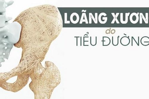 Bệnh đái tháo đường gia tăng nguy cơ gãy xương