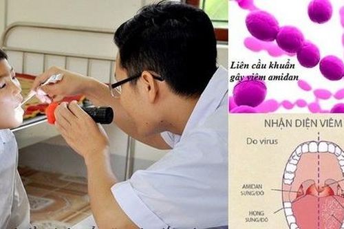 Chuyển mùa, cảnh giác với viêm họng cấp ở trẻ