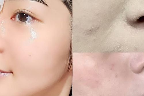 7 bí quyết giúp trang điểm ăn phấn, không bị sần sùi vào mùa đông