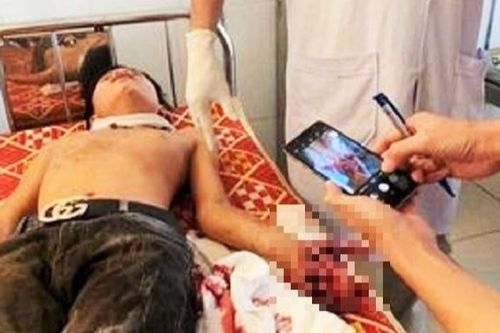 Đang học bài, laptop bất ngờ phát nổ khiến 3 học sinh nhập viện cấp cứu
