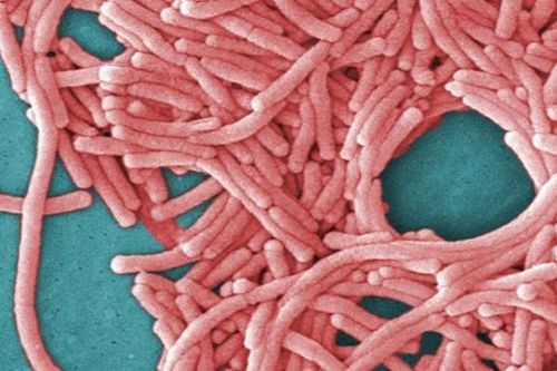 Bệnh viêm phổi do nhiễm vi khuẩn Legionella