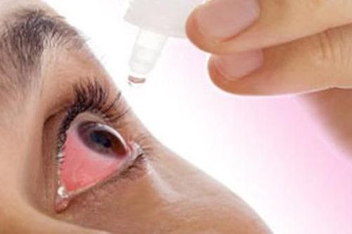 Phòng ngừa đau mắt mùa bão lũ