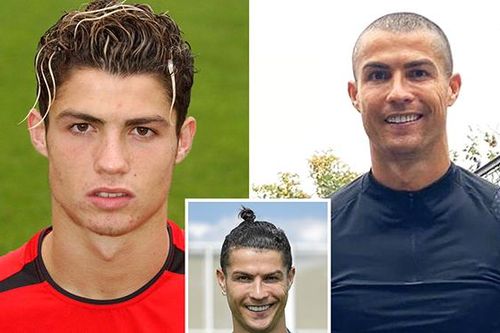 Ronaldo: Từ những mái tóc thời trang tới… đầu trọc