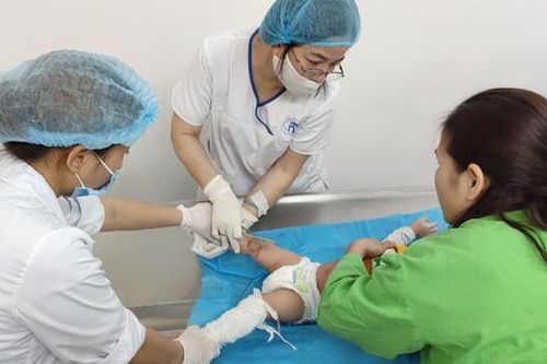 Mẹ bất cẩn khi pha sữa, bé 7 tháng tuổi bị bỏng độ II, độ III