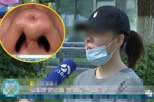 Chi hơn 80 triệu đồng để phẫu thuật thẩm mỹ, nữ streamer cay đắng nhận lại chiếc mũi với 4 lỗ