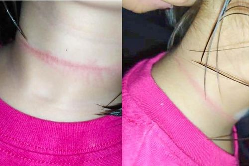 Bé gái 4 tuổi suýt mất mạng khi cố thực hiện theo thử thách treo cổ trên TikTok