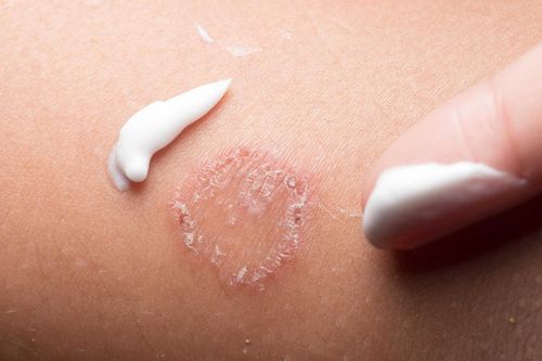 Tìm hiểu những loại nấm da thường gặp