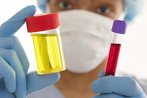 Tiểu máu, dấu hiệu của một số bệnh lý nguy hiểm