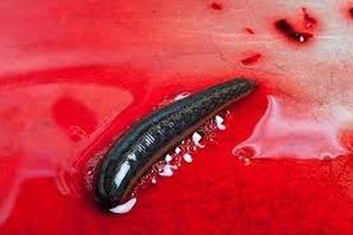 6 cách chữa cảm cúm 'hết hồn' trên thế giới