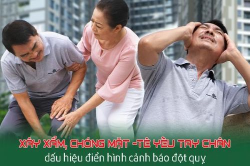 Xây xẩm, chóng mặt và tê yếu tay chân – nguy cơ đột quỵ ở người mỡ máu cao