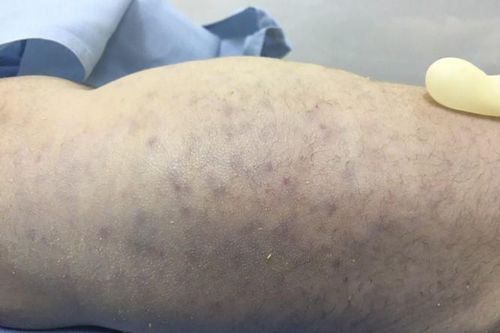 Cảnh báo loại virus dễ gây tử vong cho thai nhi