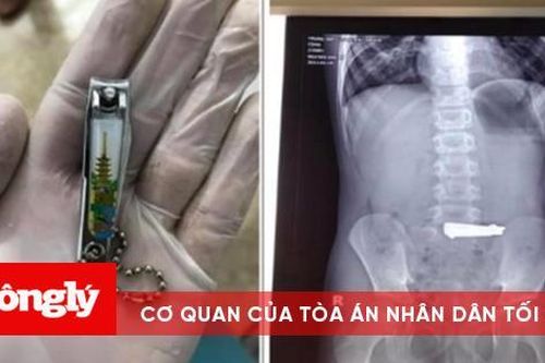 Bắt chước video trên mạng, bé trai nuốt cả bấm móng tay vào bụng