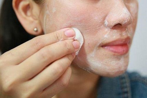 Hệ lụy khôn lường khi dùng kem đánh răng trị mụn