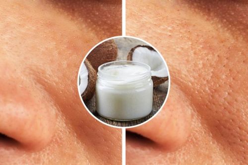 7 cách chăm sóc da tưởng đúng mà sai