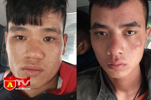 Dùng xi lanh, dao chặn đường cướp xe máy