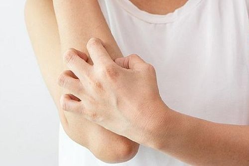 Những biện pháp ngăn ngừa nguy cơ nhiễm nấm da