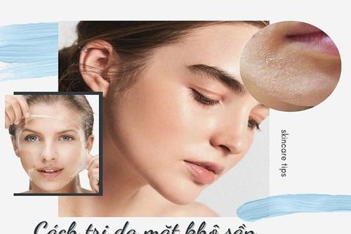 Tạm biệt lớp da bong tróc kém sắc với các cách trị da mặt khô sần đơn giản này