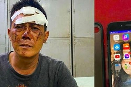 Tự đập đầu chảy máu sau khi dùng kim tiêm cướp tài sản