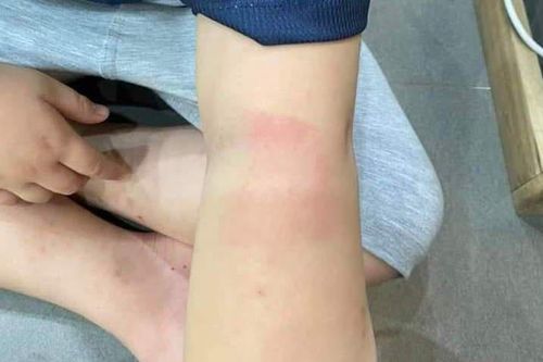 Kỷ luật cô giáo dùng thước đánh học sinh