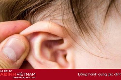 Bé gái suýt bị điếc vì khối cholesteatoma ăn mòn xương tai