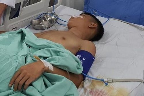 Thanh niên trúng nhiều phát đạn súng hoa cải trong vụ hỗn chiến