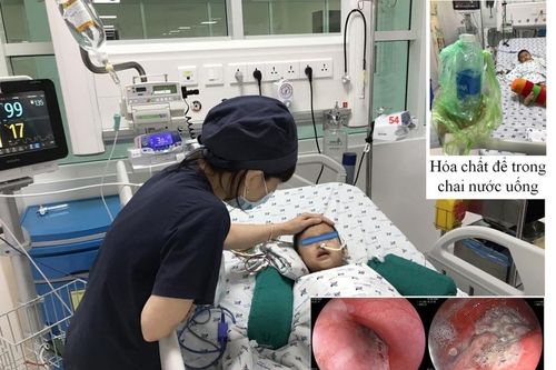 Cứu sống bé trai 3 tuổi ở miền Tây uống nhầm hóa chất