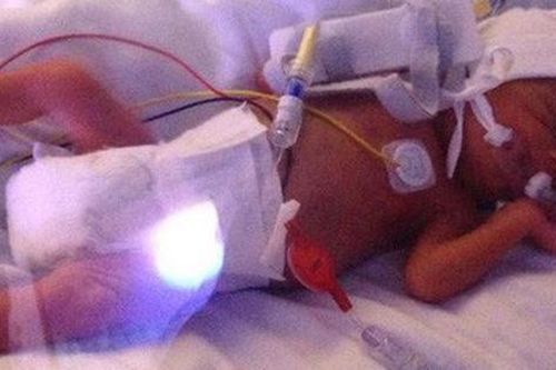 Bé gái mắc bệnh hiểm nghèo khó sống, bác sĩ bất lực trả về gia đình nhưng hành động chơi đùa vô tư của chị gái đã cứu em thoát khỏi 'Tử thần'