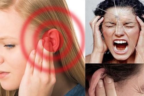 Đừng đùa với… ù tai