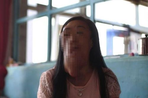 Người phụ nữ ở Trung Quốc mang 'khuôn mặt voi'