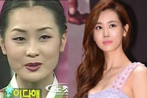 Lee Da Hae được nhận xét 'mỗi năm một khuôn mặt'