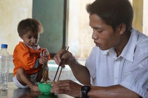 Quảng Ngãi: Cậu bé tí hon qua đời ở tuổi 11