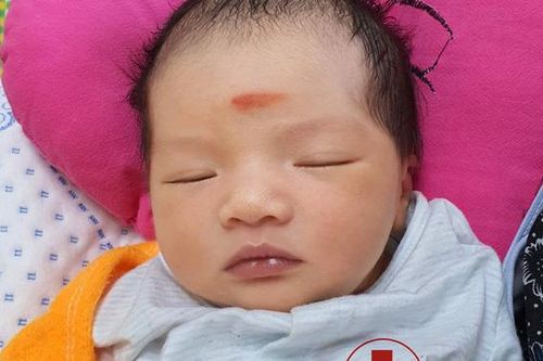 Khẩn cấp cứu sống thai nhi bị sa dây rau