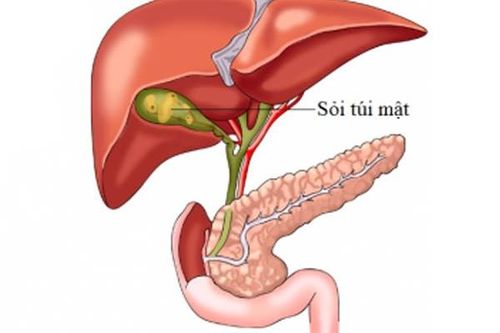 Điểm mặt nguyên nhân gây đau bụng ở người cao tuổi