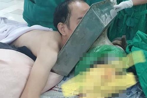 Bệnh nhân bị cối xay thịt nghiền nát cánh tay
