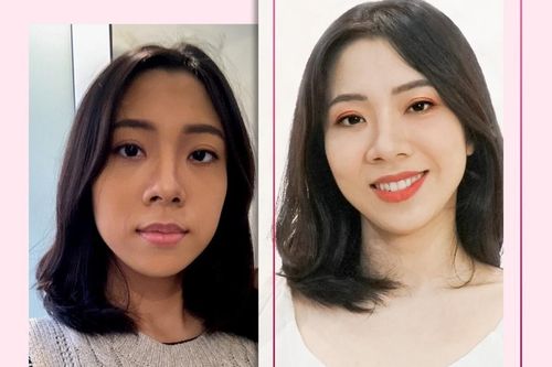 Detox trắng da - Light Fusion khắc tinh của làn da đen sạm, lão hóa chinh phục hàng ngàn phụ nữ Việt