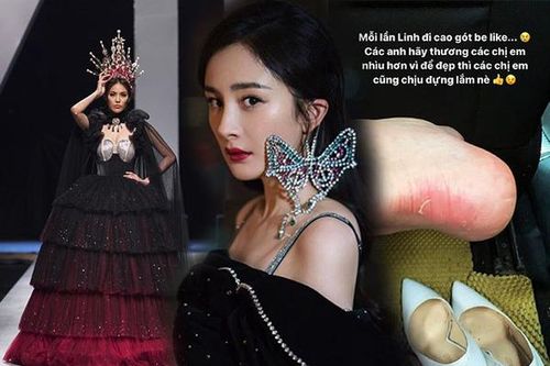Chịu đau để mặc đẹp: Mỹ nhân Việt 'vồ ếch' thấy thương, sao Trung bị biến dạng cả vành tai