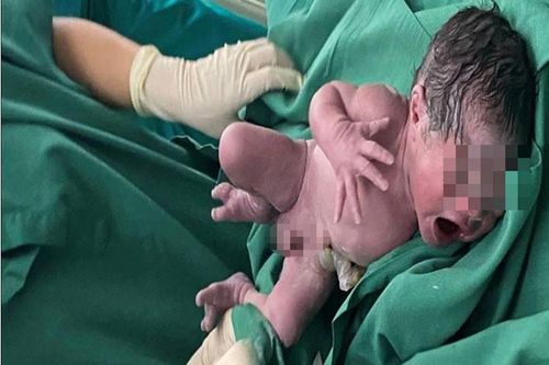 Mẹ vừa mang thai vừa hóa trị, con chào đời khỏe mạnh