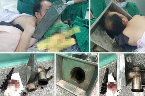 TP.HCM: Người đàn ông bị máy xay thịt 'nuốt' trọn cánh tay