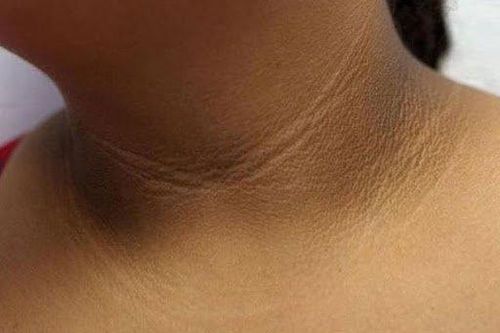 Nếu có những dấu hiệu này trên da, bạn nên đến viện khám ngay