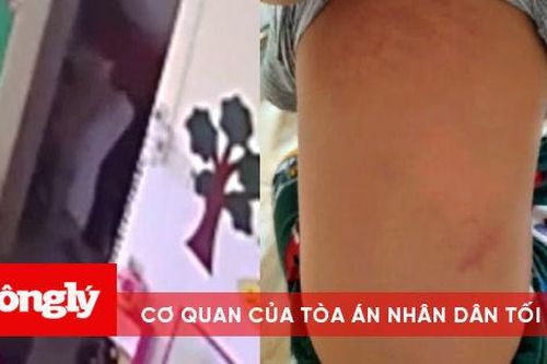 Điều tra vụ giáo viên bạo hành bé 15 tháng tuổi trong nhà vệ sinh