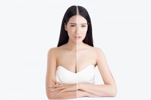 Ưu điểm của làm trắng từ bên trong so với làm trắng từ bên ngoài